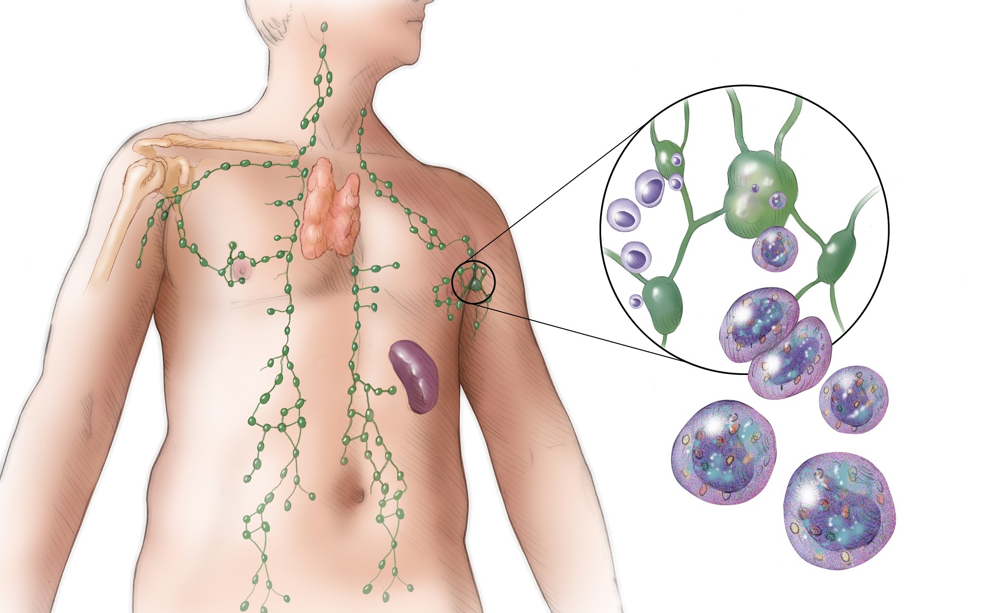 Melanoma Cancer Treatments Image