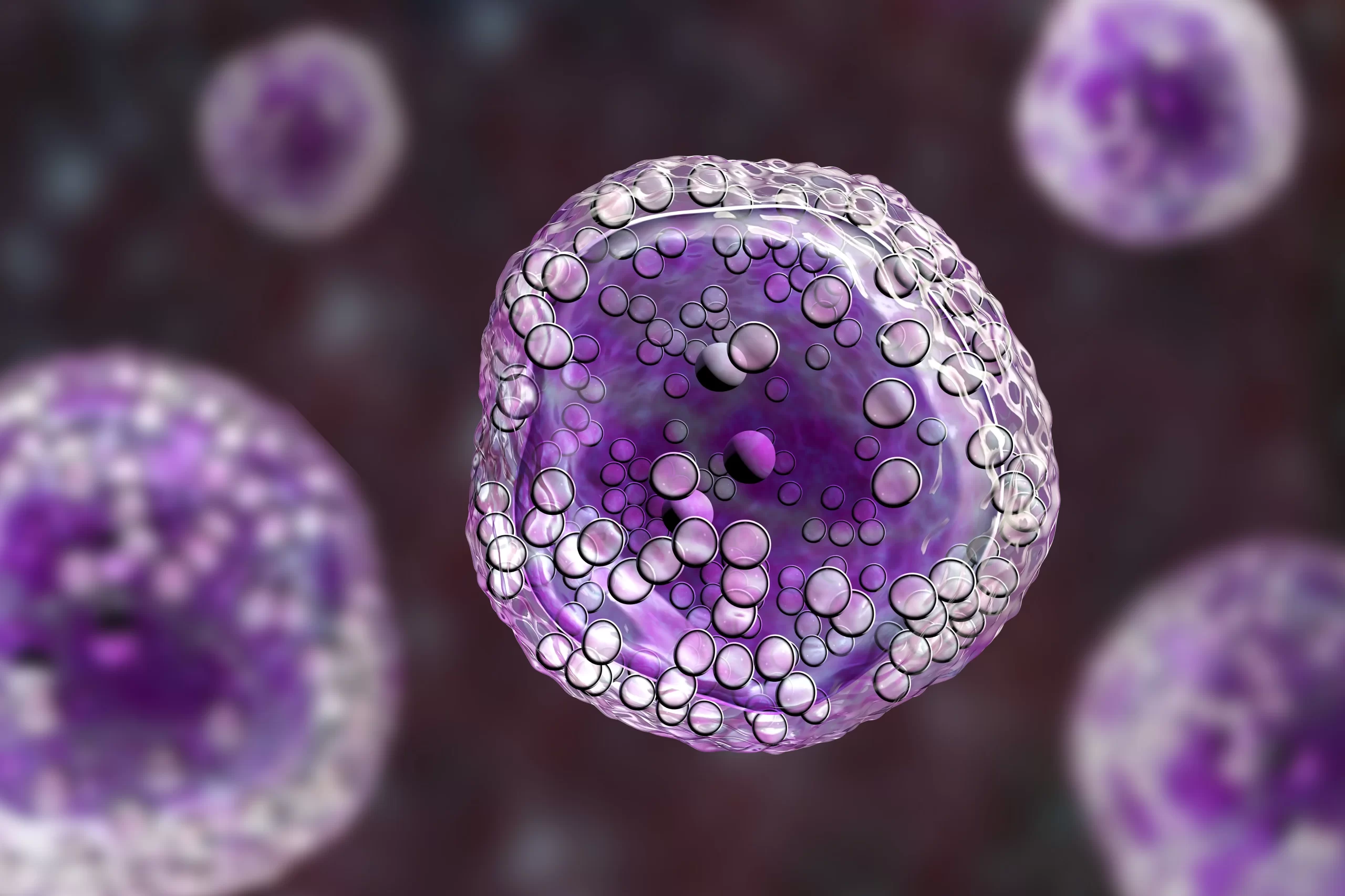 Types Of Hodgkin Lymphoma Cancer Image