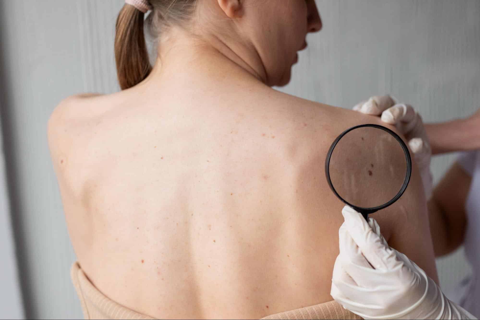 Ignored Cancer Symptoms