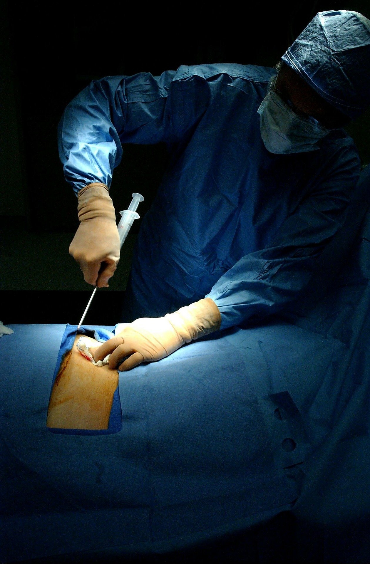 Expert Bone Marrow testing