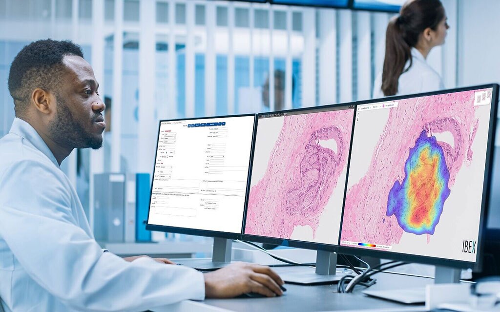 Cancer Diagnosis Image