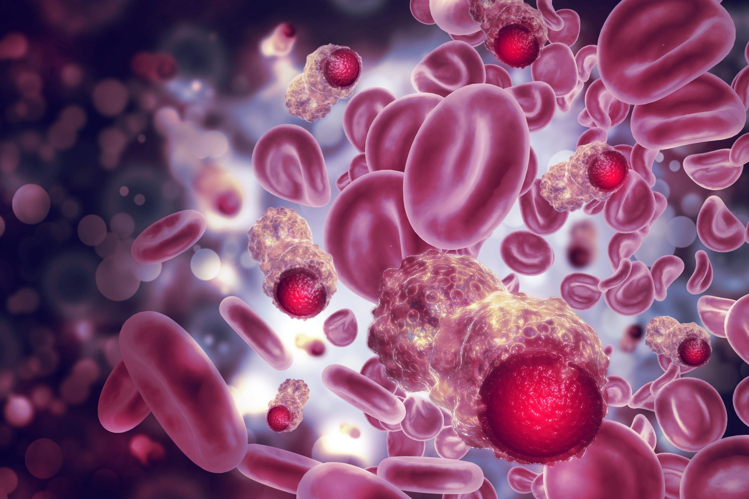 Causes Of Blood Cancer Image