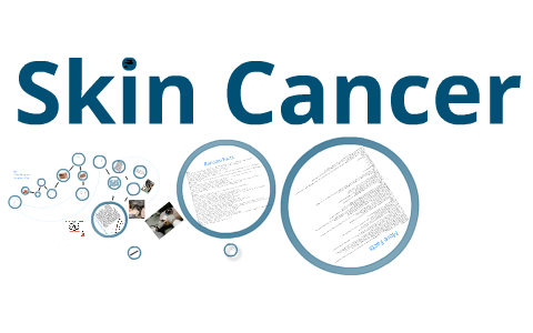 Skin Cancer Myths