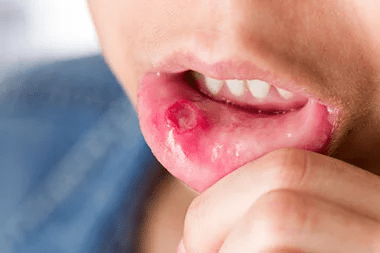 the effects of dipping tobacco Smokeless Tobacco
