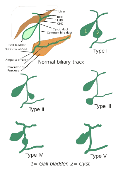 Types Of Gall Bladder Cancer​ Image