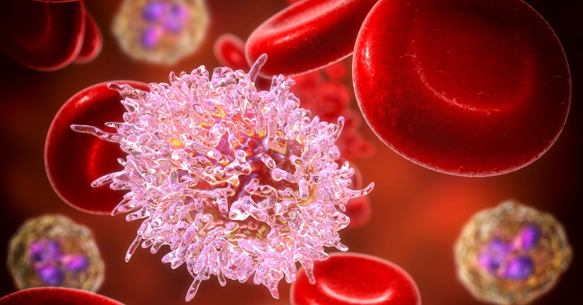 Blood Cancer Diagnosis Image