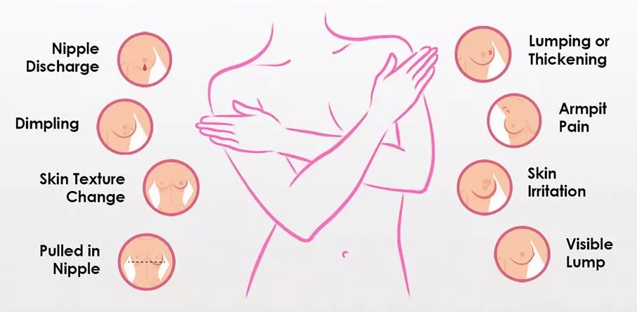 Symptoms Of Breast Cancer Image