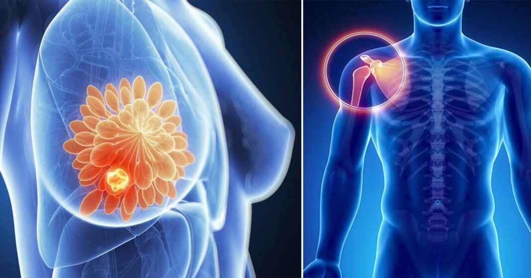 Soft Tissue Sarcoma Cancer Treatments​