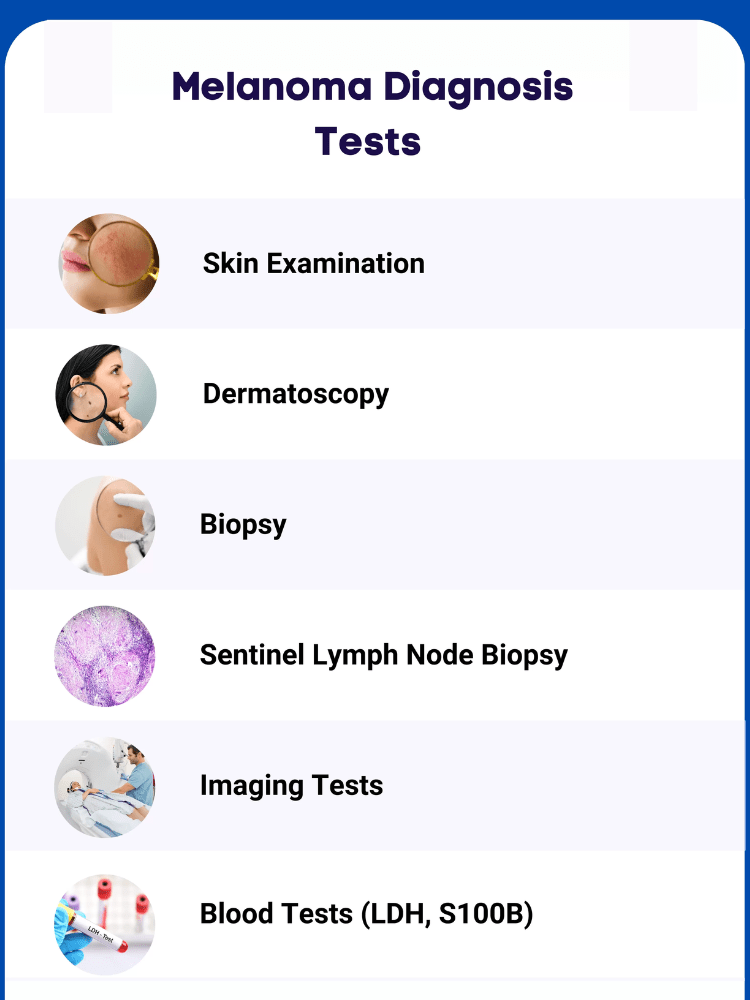 Melanoma Cancer Diagnosis Image