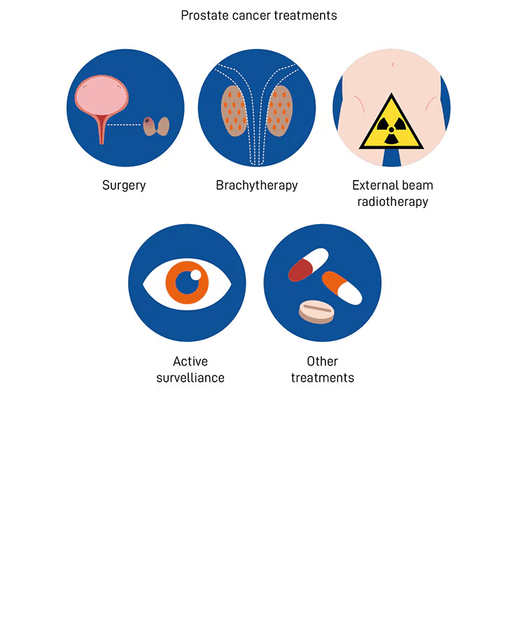 Prostate Cancer Treatments​