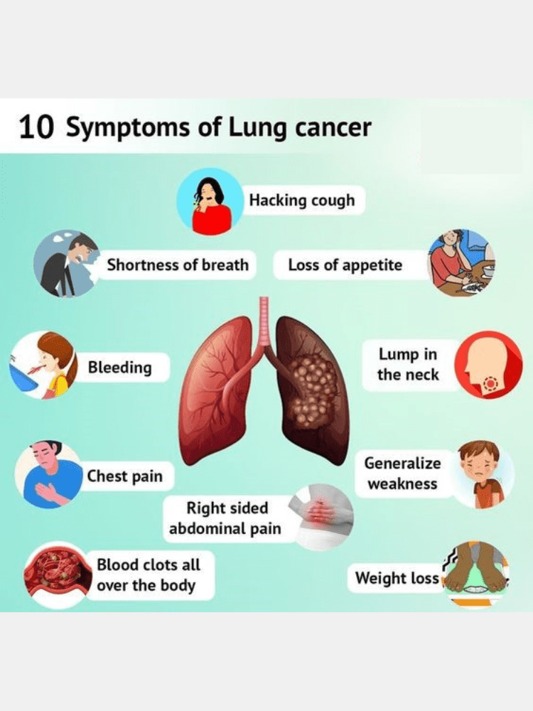 lung cancer Symptoms Image