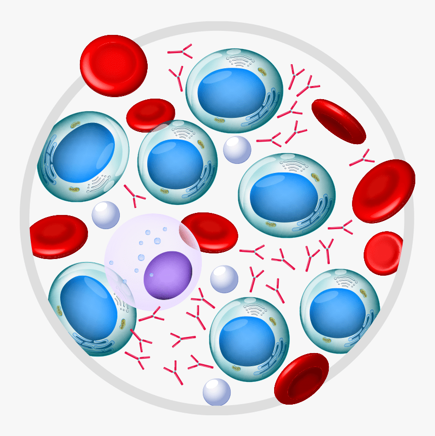 Occurrence of Multiple Myeloma Cancer​