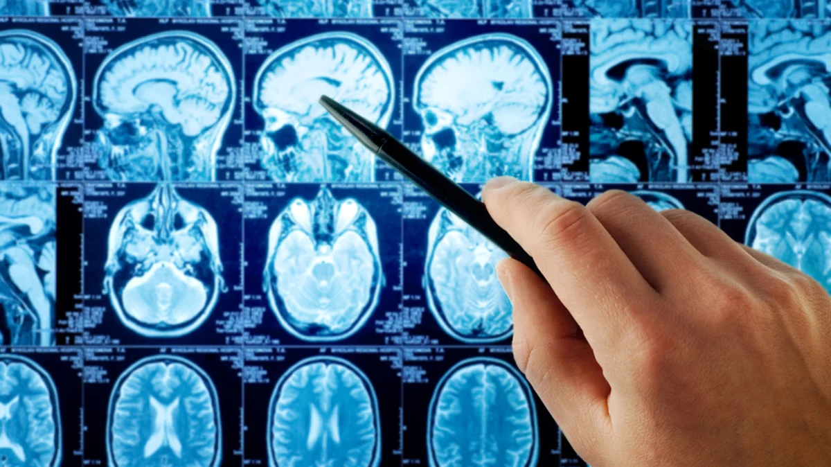 Head and Neck Cancer Treatments Image