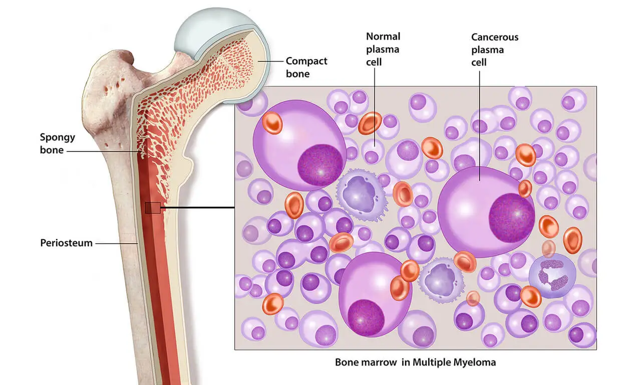 Prostate Cancer diagnosis​