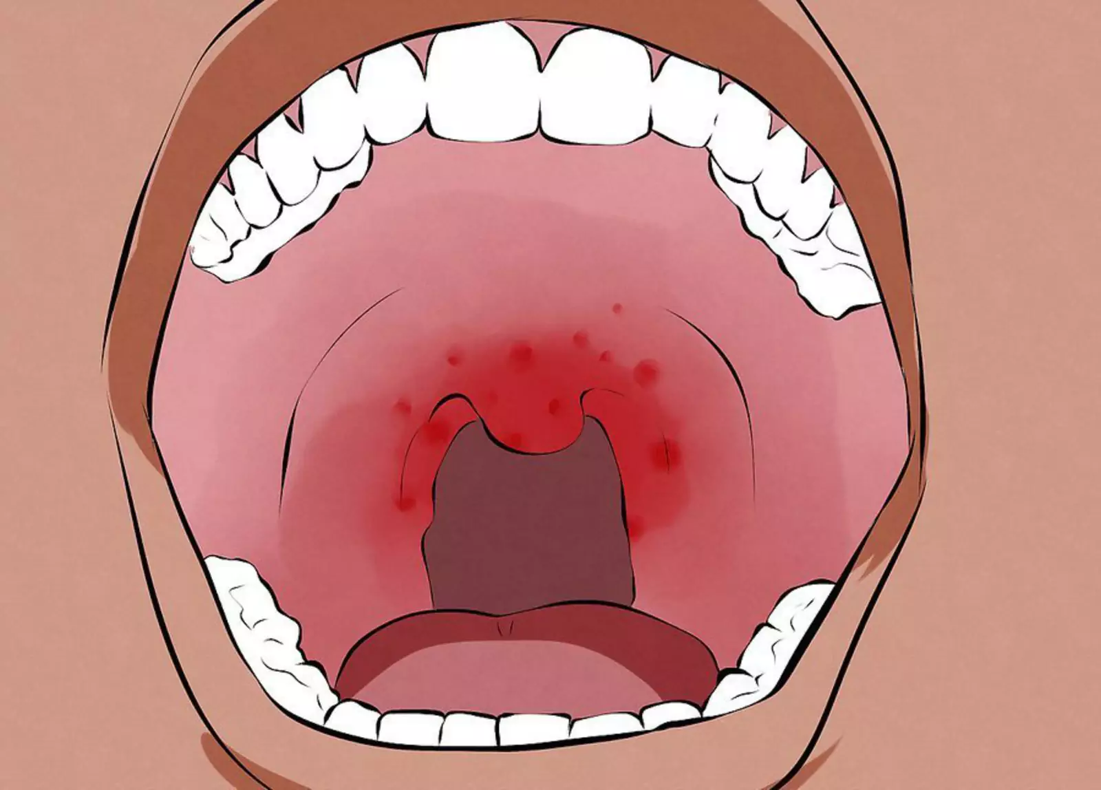 Risk Factors & Causes of Oral Cancer​