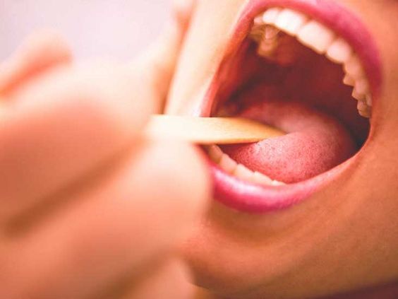 Recovery from Throat Cancer​