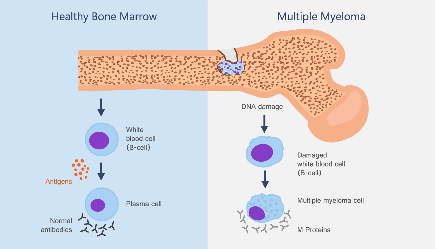Prostate Cancer Treatments​