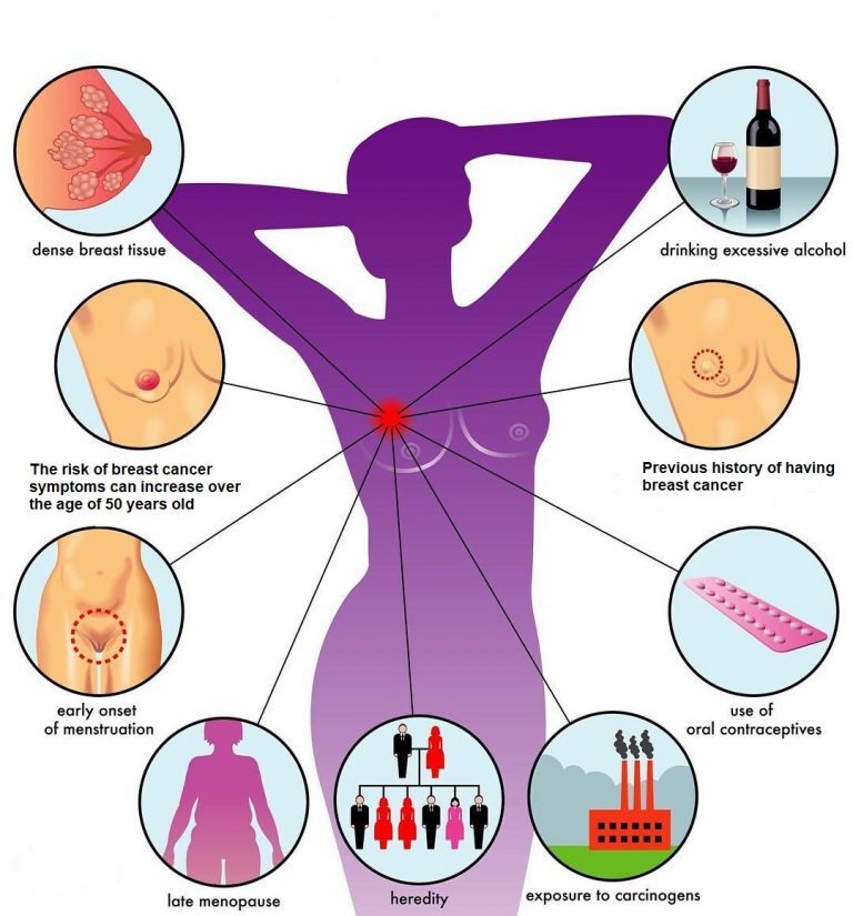 Breast Cancer Risk Factors Image