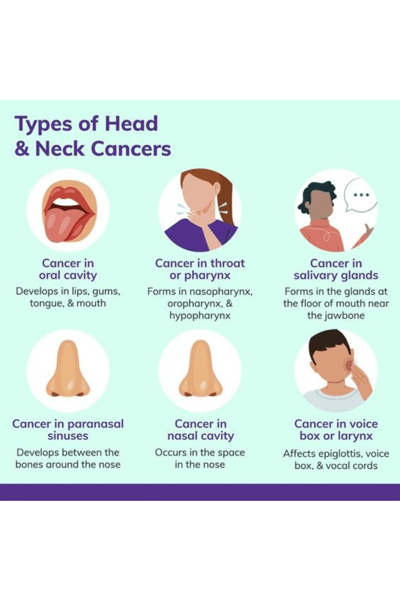 Types Of Head and Neck Cancer Image