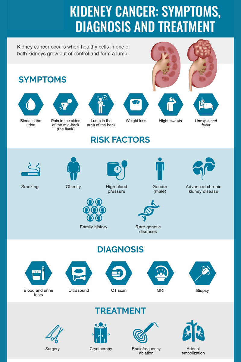 Kidney Cancer Treatments Image