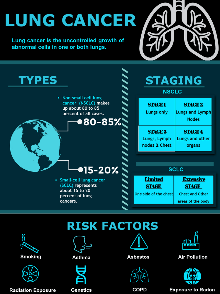 Lung Cancer Treatments Image