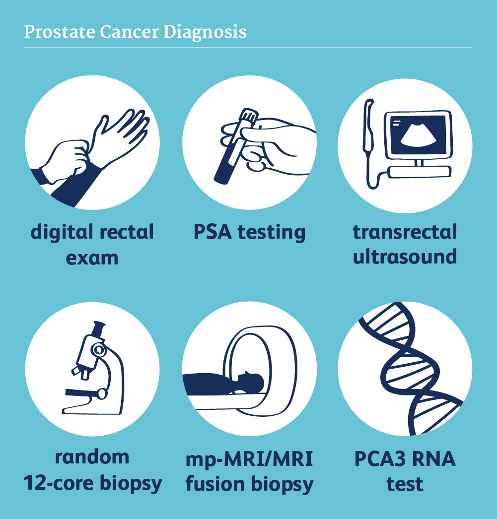Prostate Cancer Diagnosis​