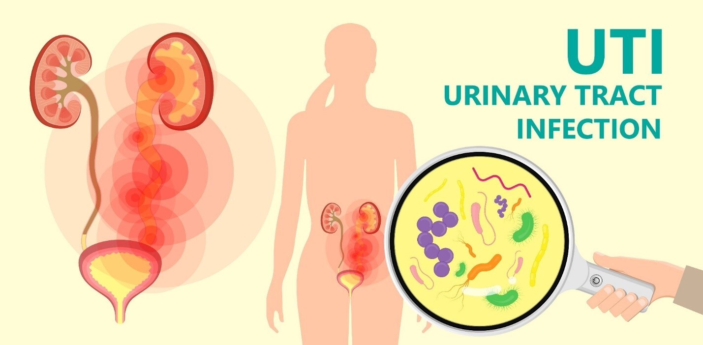 UTI Causes & Preventions