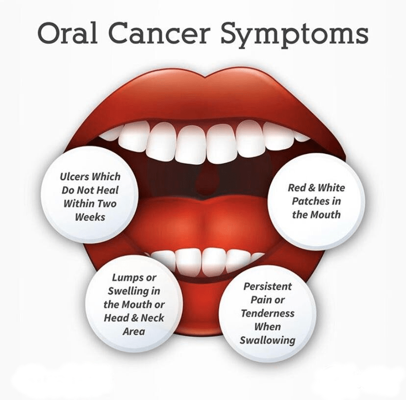 Oral Cancer Symptoms